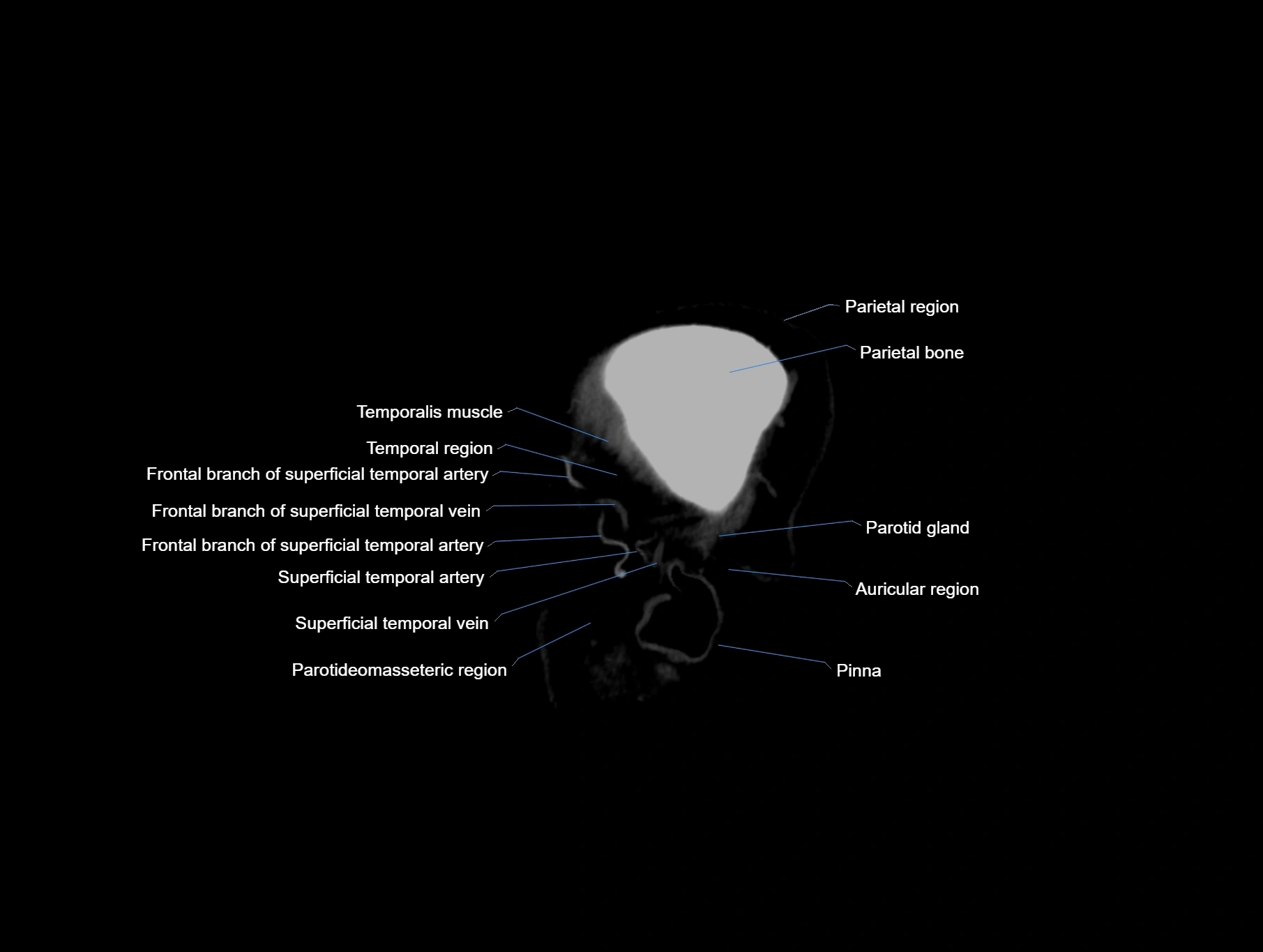 CT scan brain sagittal cross sectional anatomy image-img-00001-00004.webp